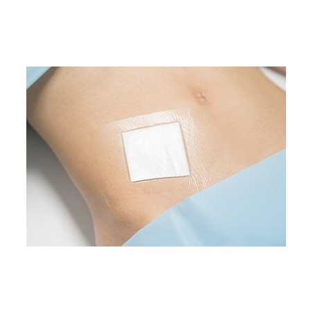Surgical Adhesive Film Dressing 120x260mm